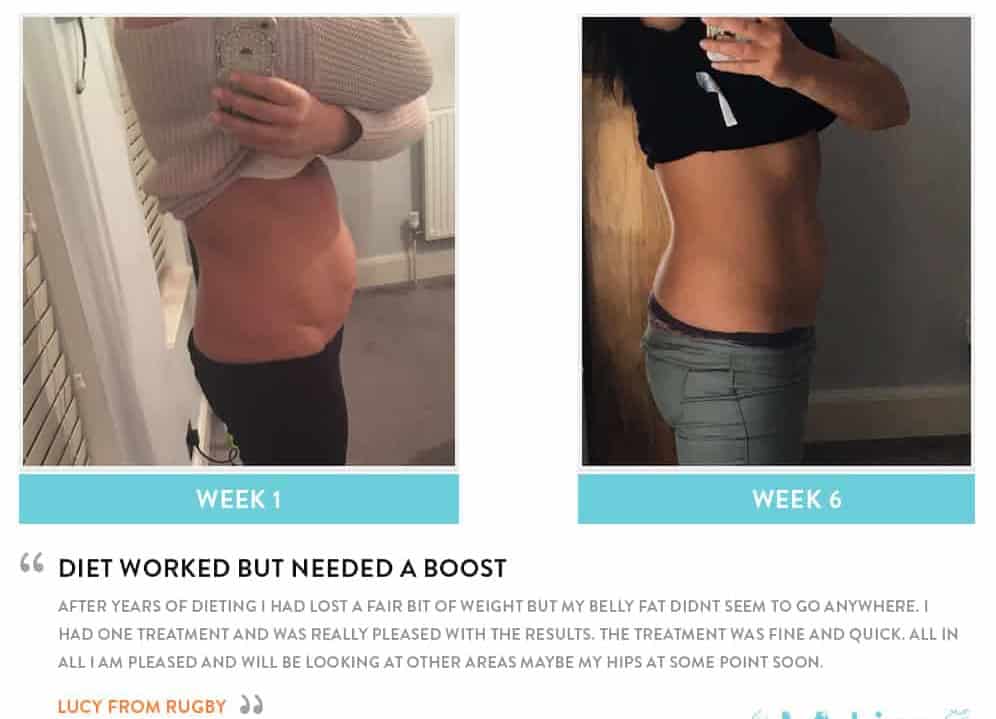 Before and After Dieting Macclesfield
