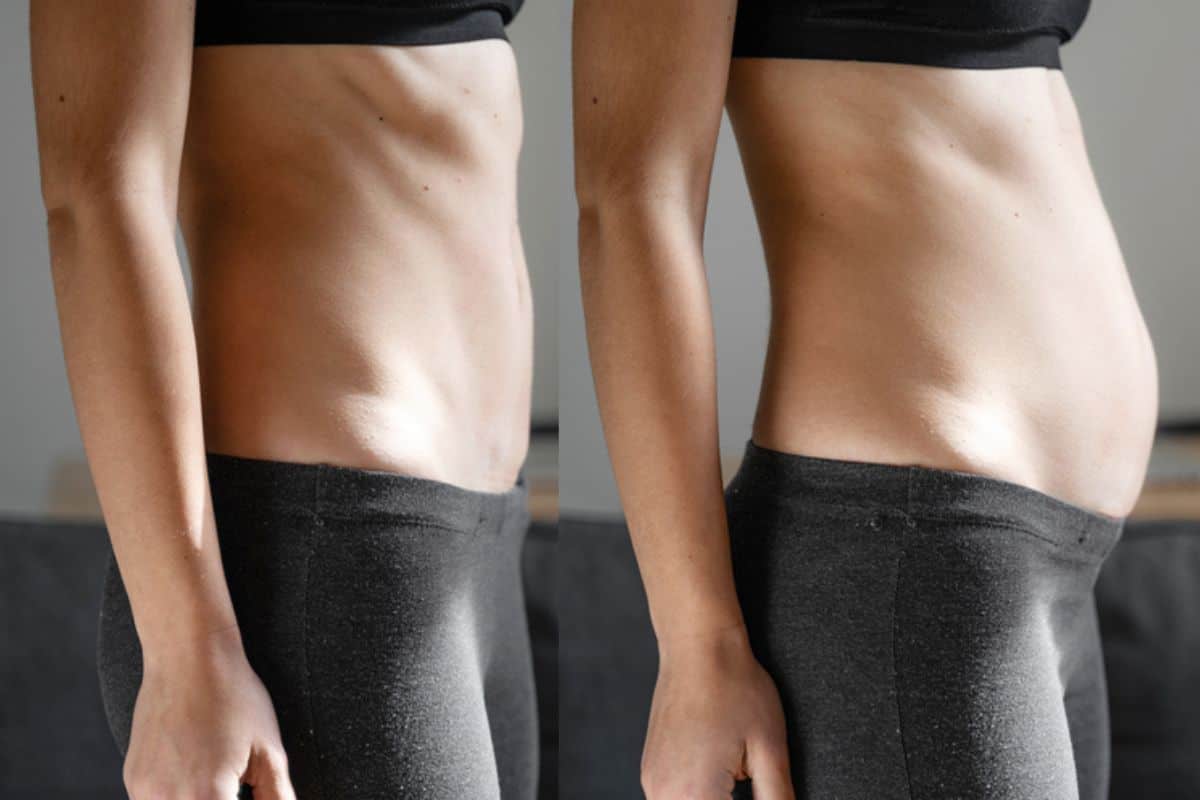 How long does diastasis recti take to improve Macclesfield?