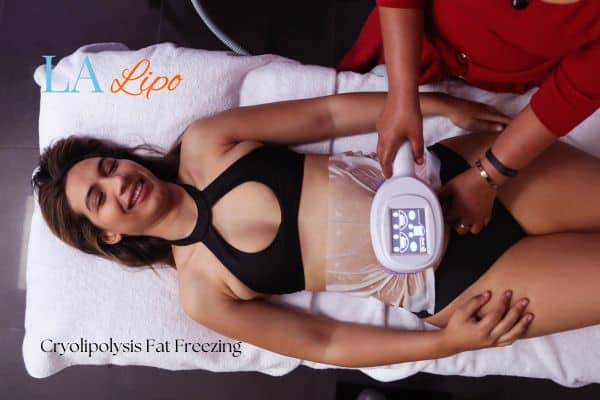 woman getting cryolipolysis Macclesfield