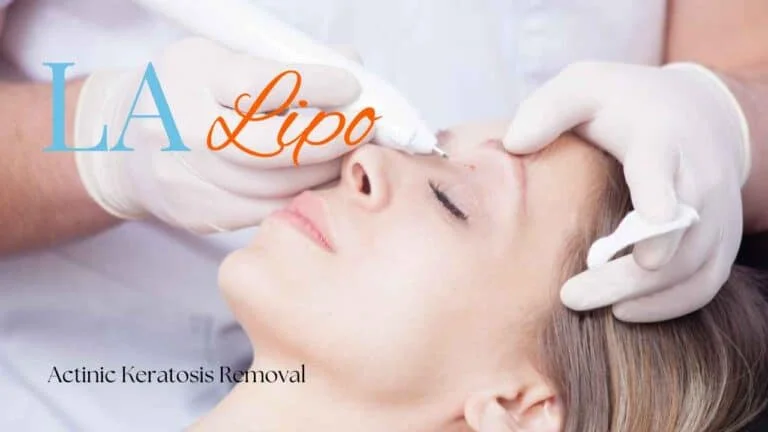 Woman receiving Actinic Keratosis Removal Treatment Macclesfield