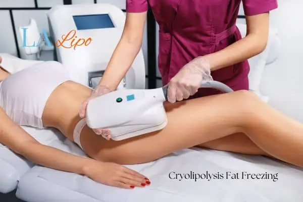 Woman receiving coolsculpting Macclesfield treatment on her thighs