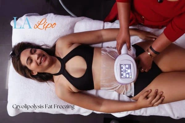 woman getting cryolipolysis Macclesfield