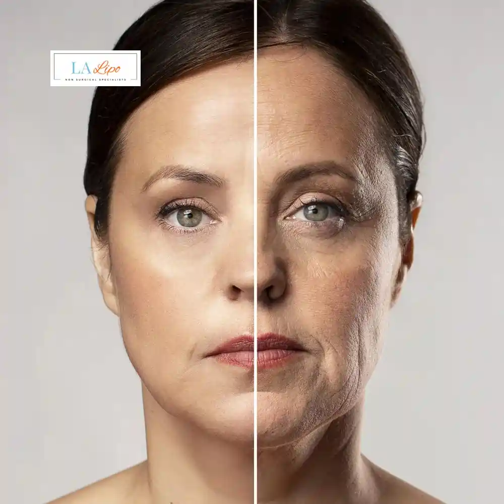 How Can You Tell If Non-Surgical Skin Tightening Is Right for You Macclesfield?