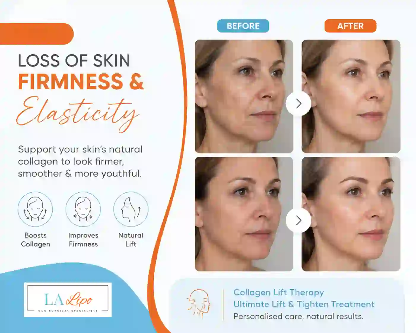 Sign #7: Loss of Skin Firmness and Elasticity Macclesfield